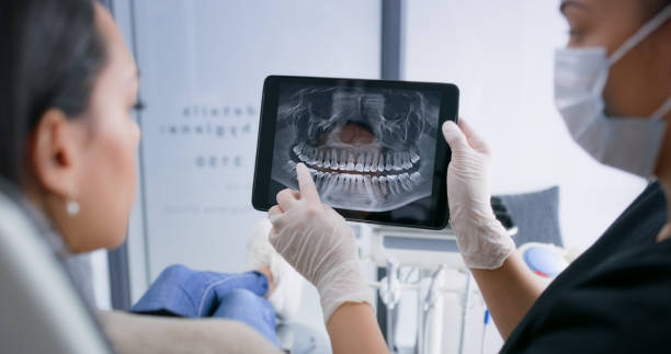 Licensed Teeth Whitening service in Heath, TX - Smile Center Dentistry